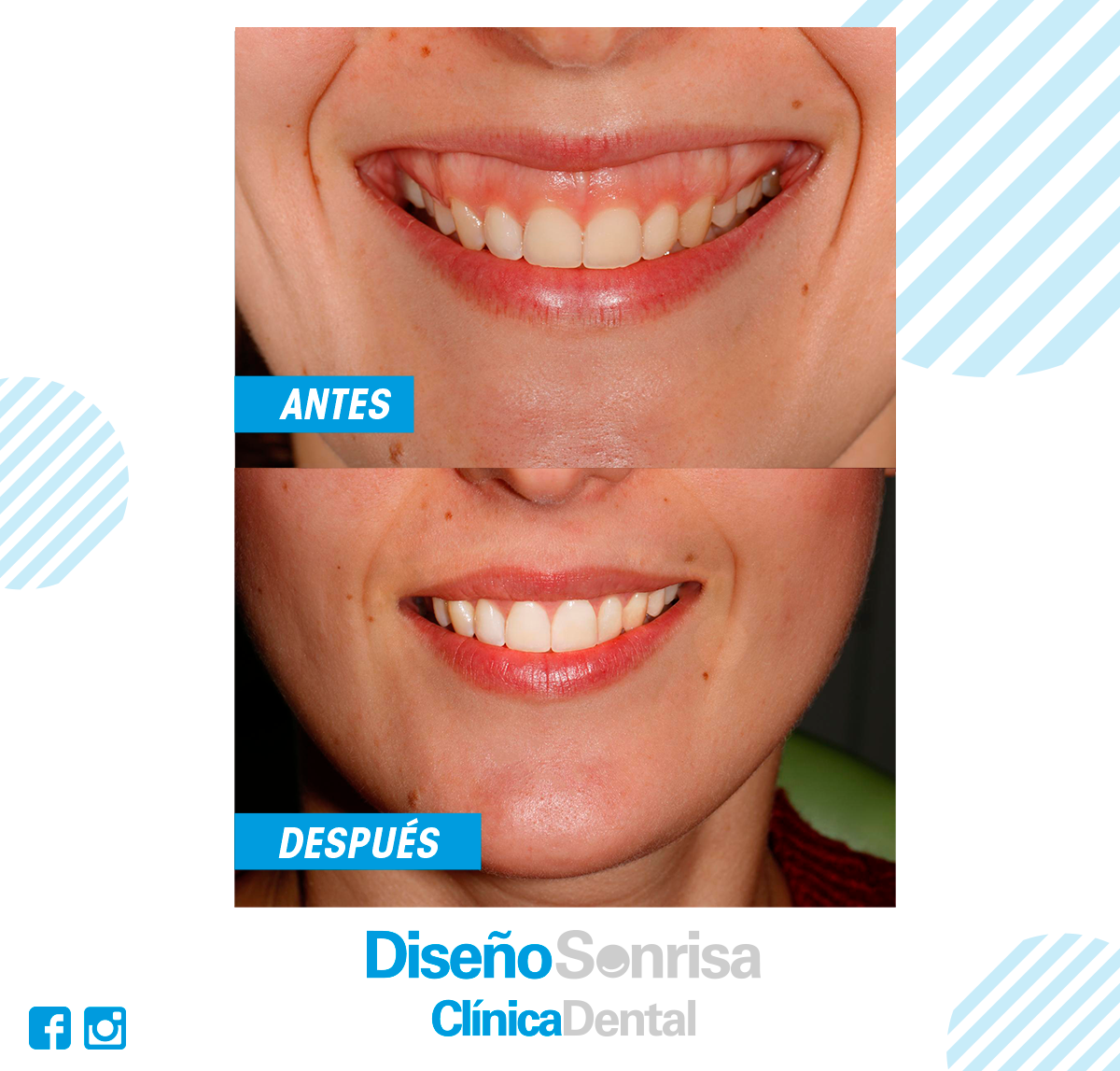 Clínica Dental Super Sonrisas: Opiniones y Servicios de Odontología